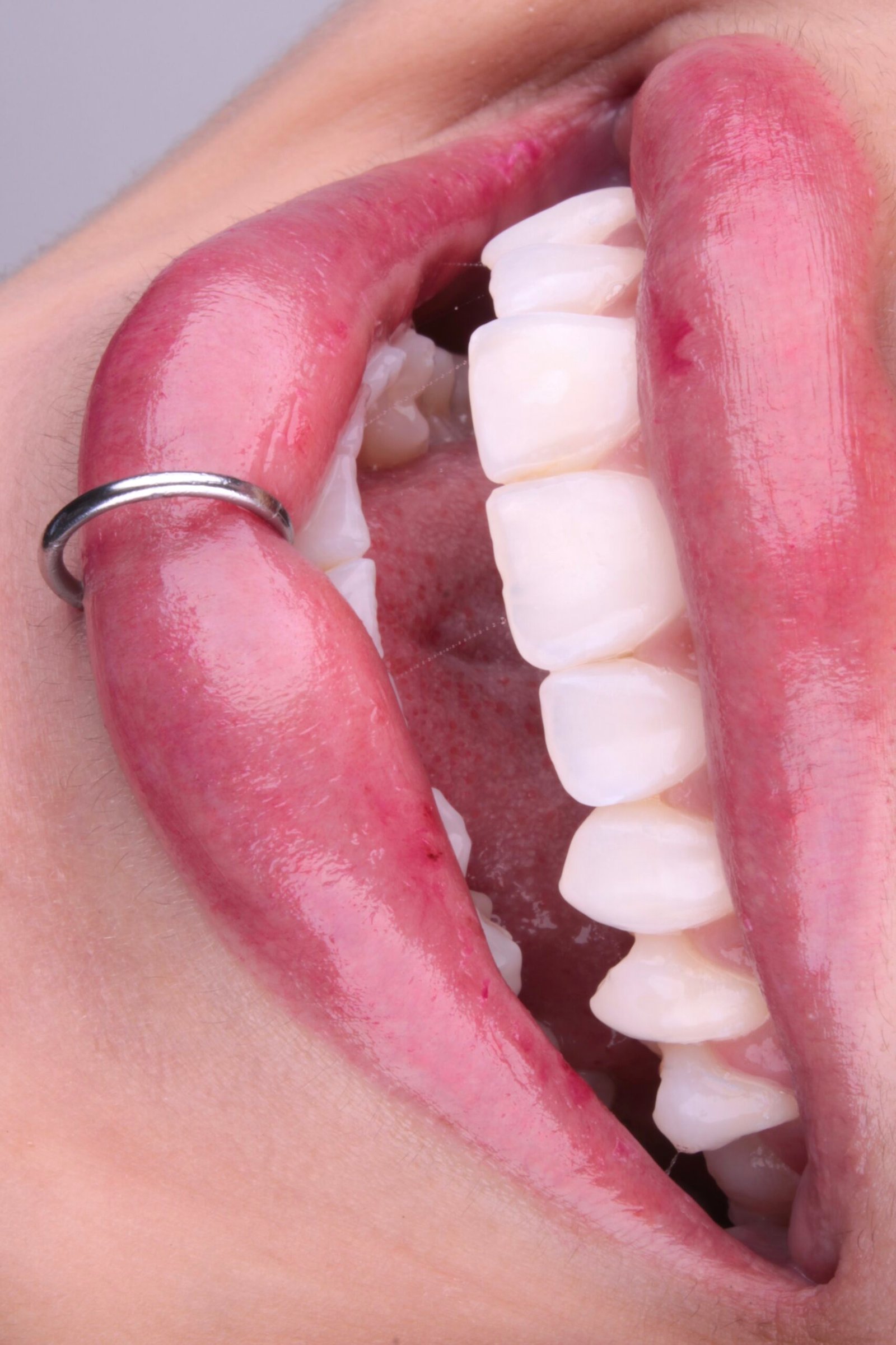 Sorriso conduzido pela Dra. Gabriela Veronez
